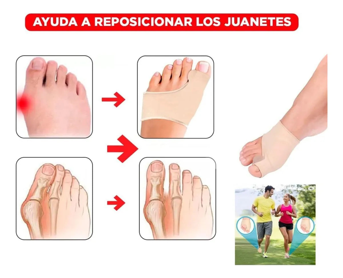Media ortopédica contra los juanetes