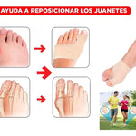 Media ortopédica contra los juanetes